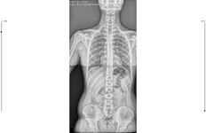teletip_1785059429938.png